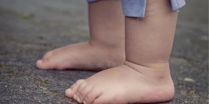 Niño de 19 meses lucha por su vida tras caer desde un tercer piso en el Norte