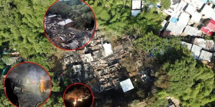 Una de las personas quemadas en Incendio en el 12 de Octubre sufrió amputación