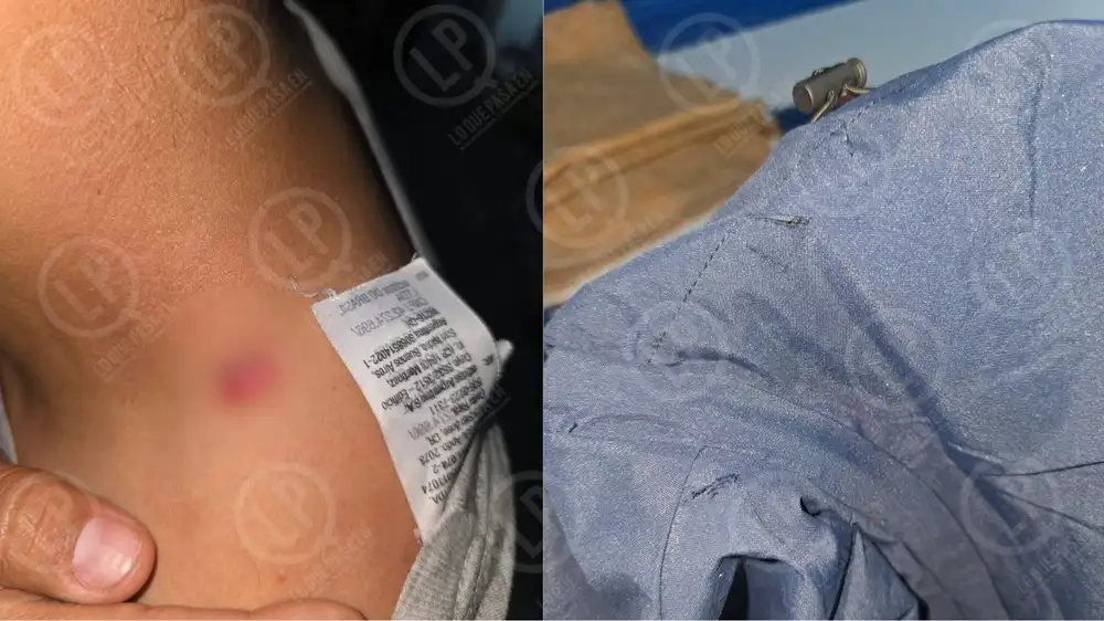 Mientras  comia una empanada joven fue atacado por un desconocido. Ya le habian decomisado varios cuchillos