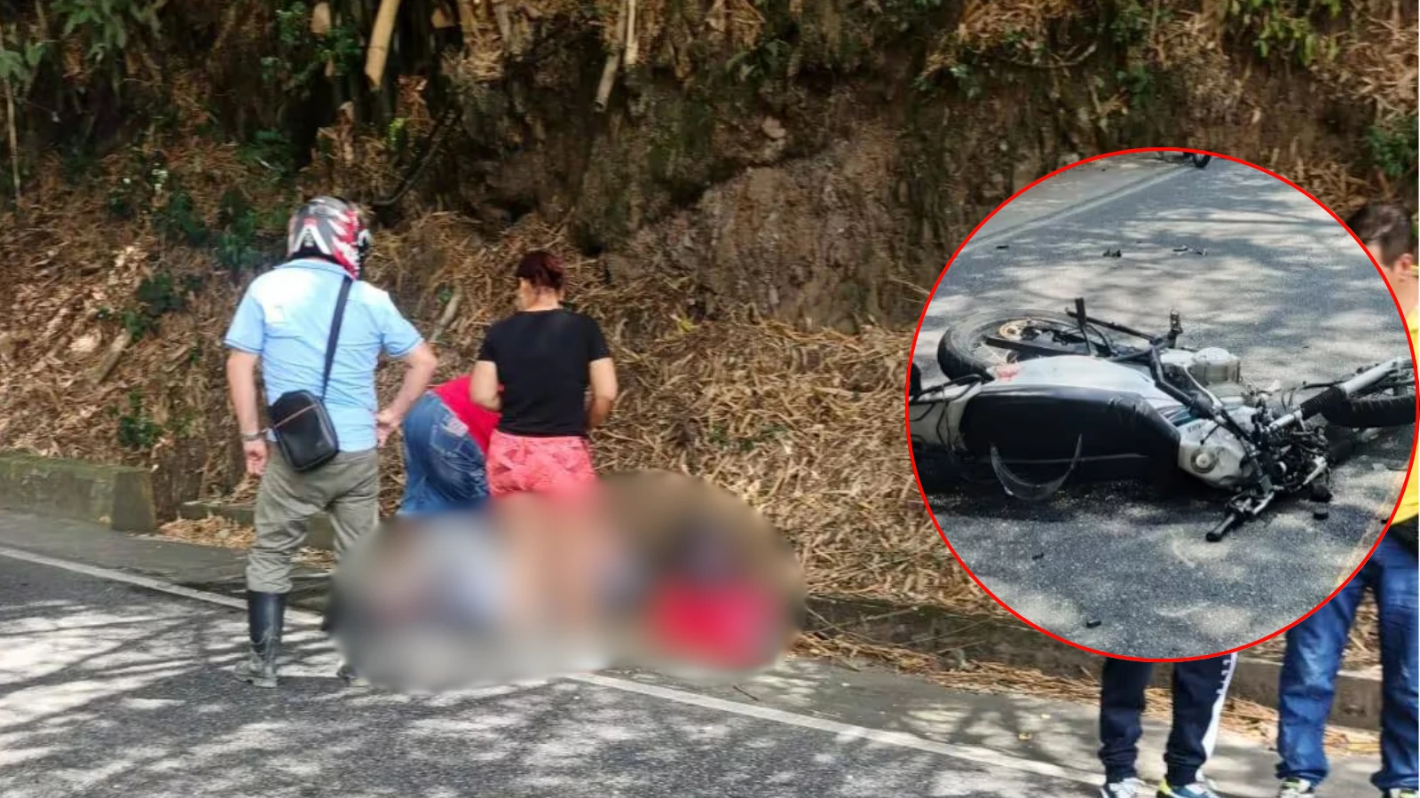 Motociclista perdió un pie tras chocar con tractocamión en peligrosa curva