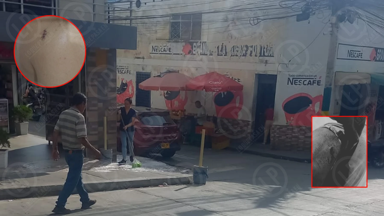 Hombre resultó herido con arma blanca tras discusión en el sector Los Rieles, La Cumbre